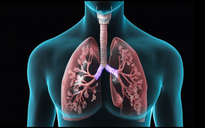 Xơ hóa phổi là gì? Bệnh xơ hóa phổi có nguy hiểm không?